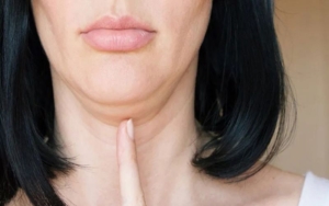 cach giam nong cam 1