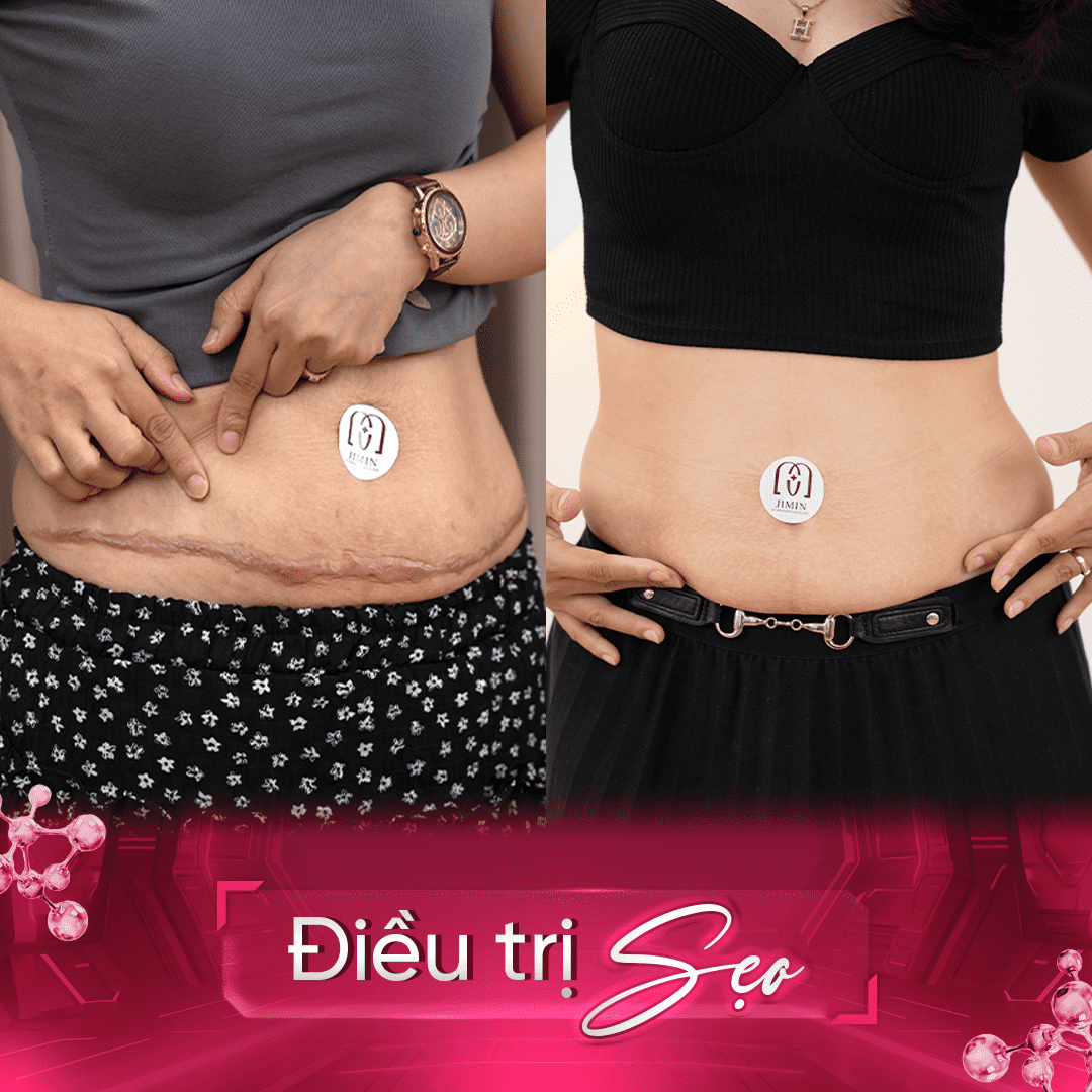 Trang chủ 104 1 optimized