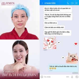 tham my jimin bi xu phat 1