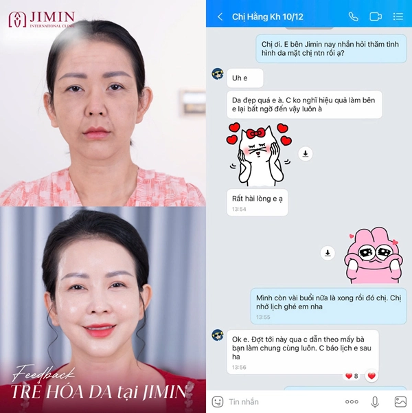 tham my jimin bi xu phat 2