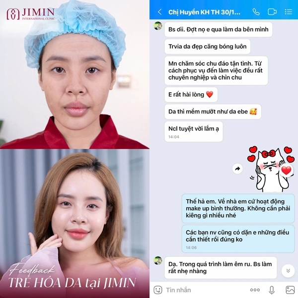 tham my jimin bi xu phat