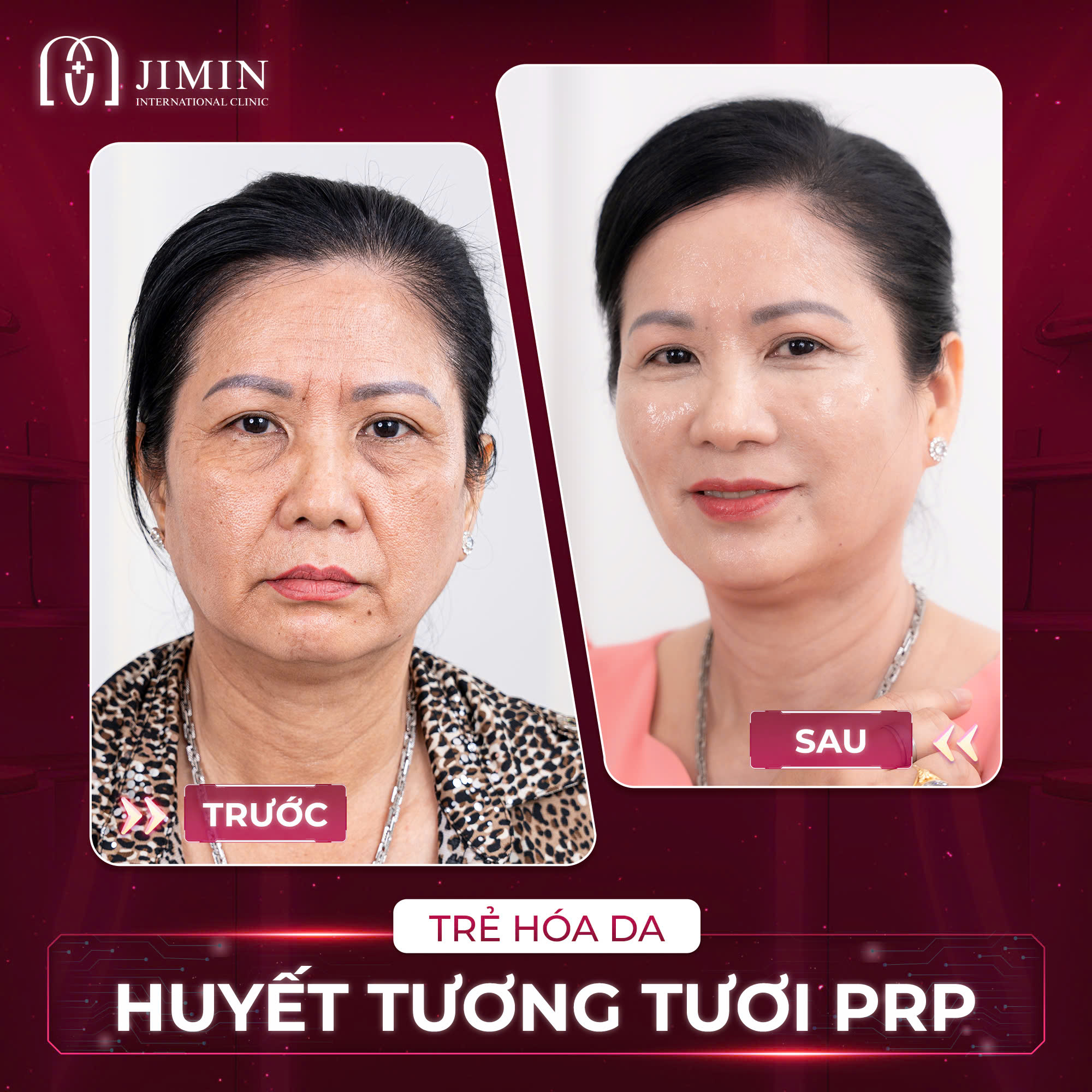 Trang chủ 107 z6624074941212 ccd137d9c165e976d1411760683e2875