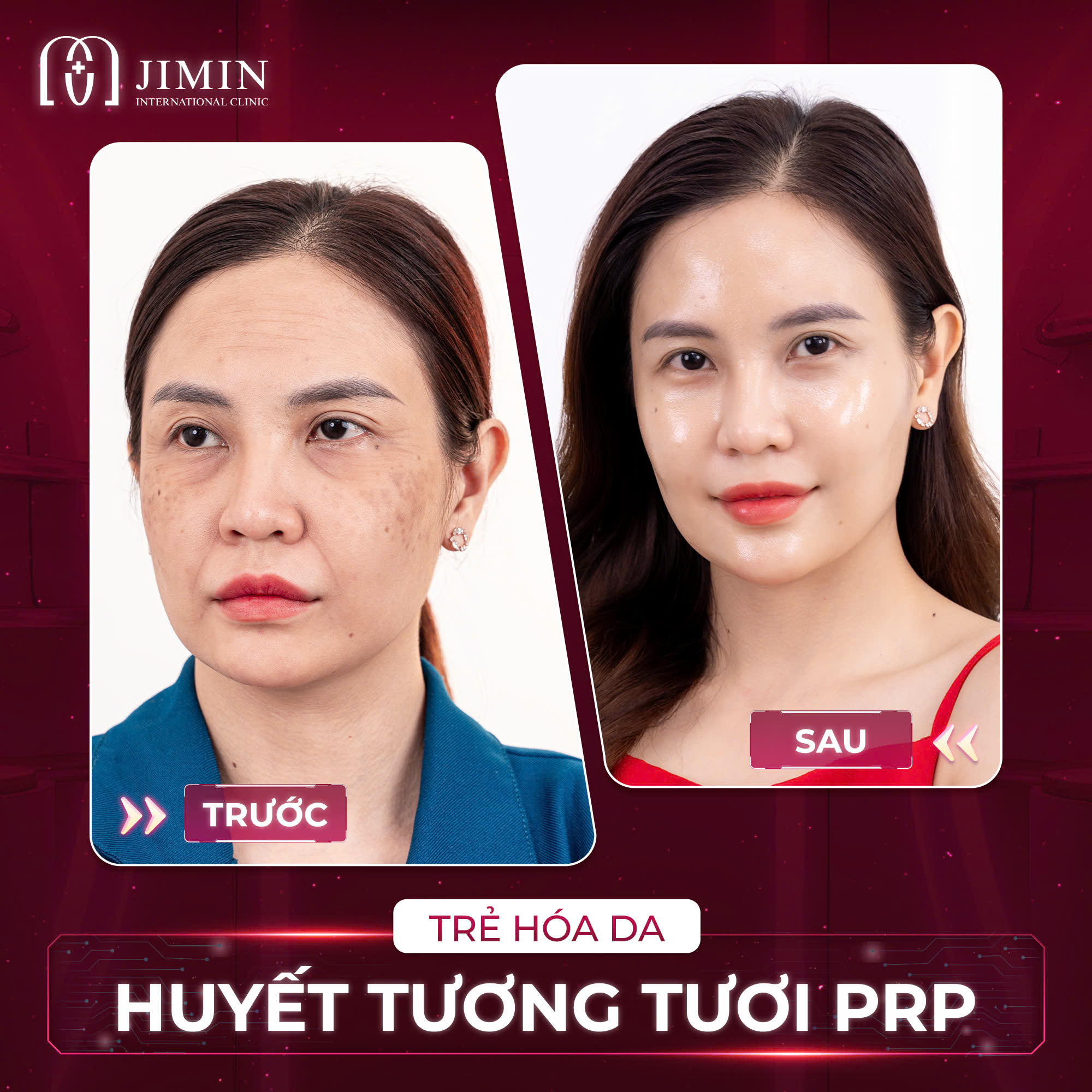 Trang chủ 105 z6624074941281 76b1b36f41fa5abf75854bfcec3422db