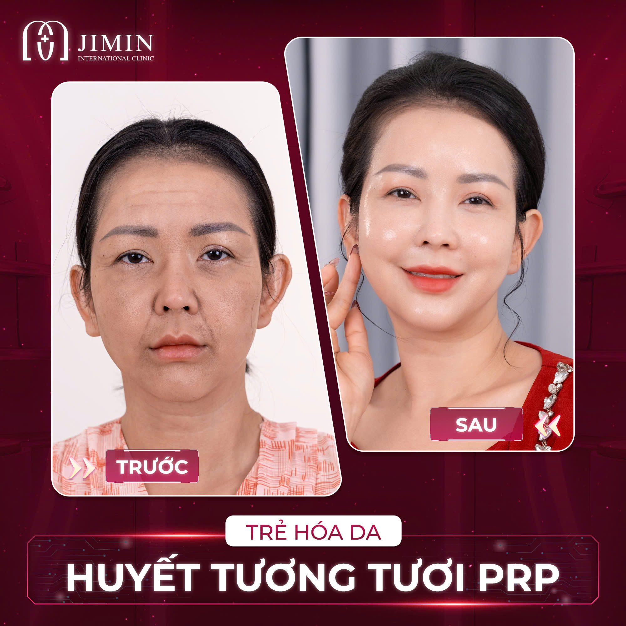 Trang chủ 99 z6624074960306 98c0f9336441be225ab643c74fdf5901