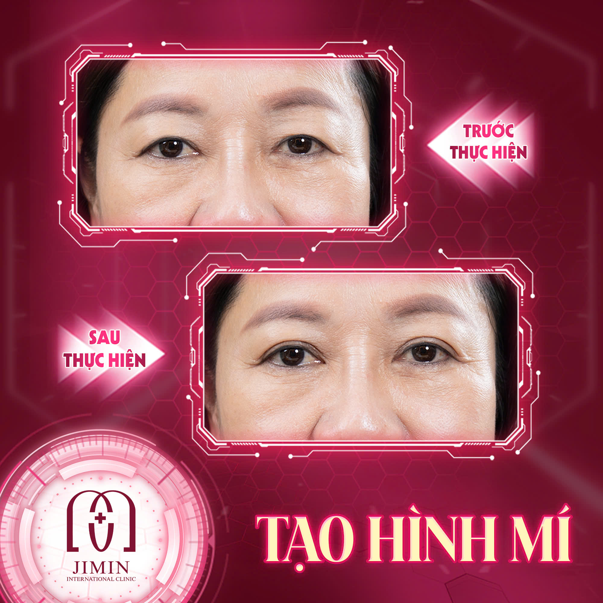 Trang chủ 100 z6624075128607 9b3347e76bb0047b883ca4fdc4d905cf